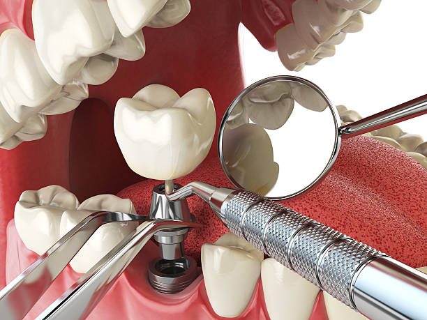 Best Emergency Dental Care for Broken or Chipped Teeth in Eagleton Village, TN